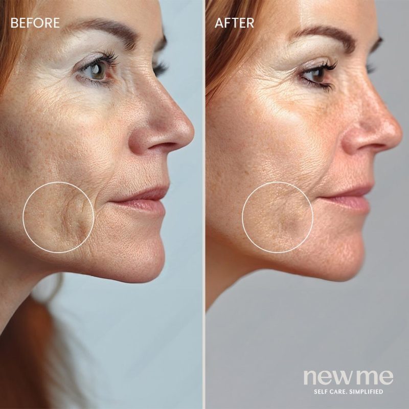 new-me-anti-ageing-serum